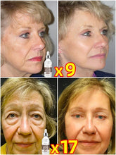 Load image into Gallery viewer, ANTI AGING SERUM LOOK
Eighteen years younger
