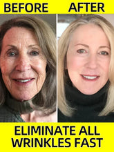 Load image into Gallery viewer, ANTI AGING SERUM LOOK
Eighteen years younger
